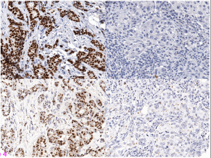 Transcriptional profiling of IncRNAs..