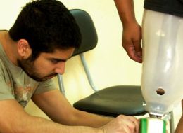 Stanford graduates partner with clinics in developing countries to test low-cost prosthetic 